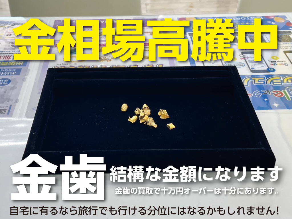 金歯の買取