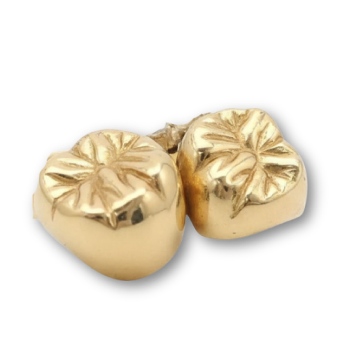 返却された金歯